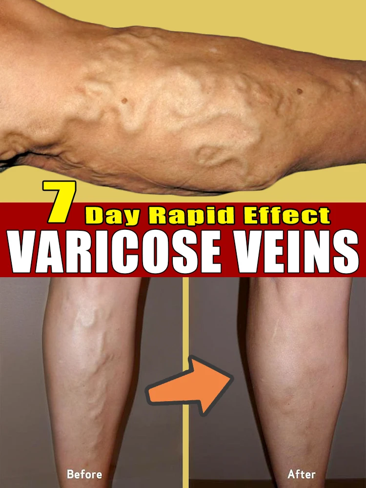 Эффективное лазерное устройство для васкулирования продукты пауков и ног