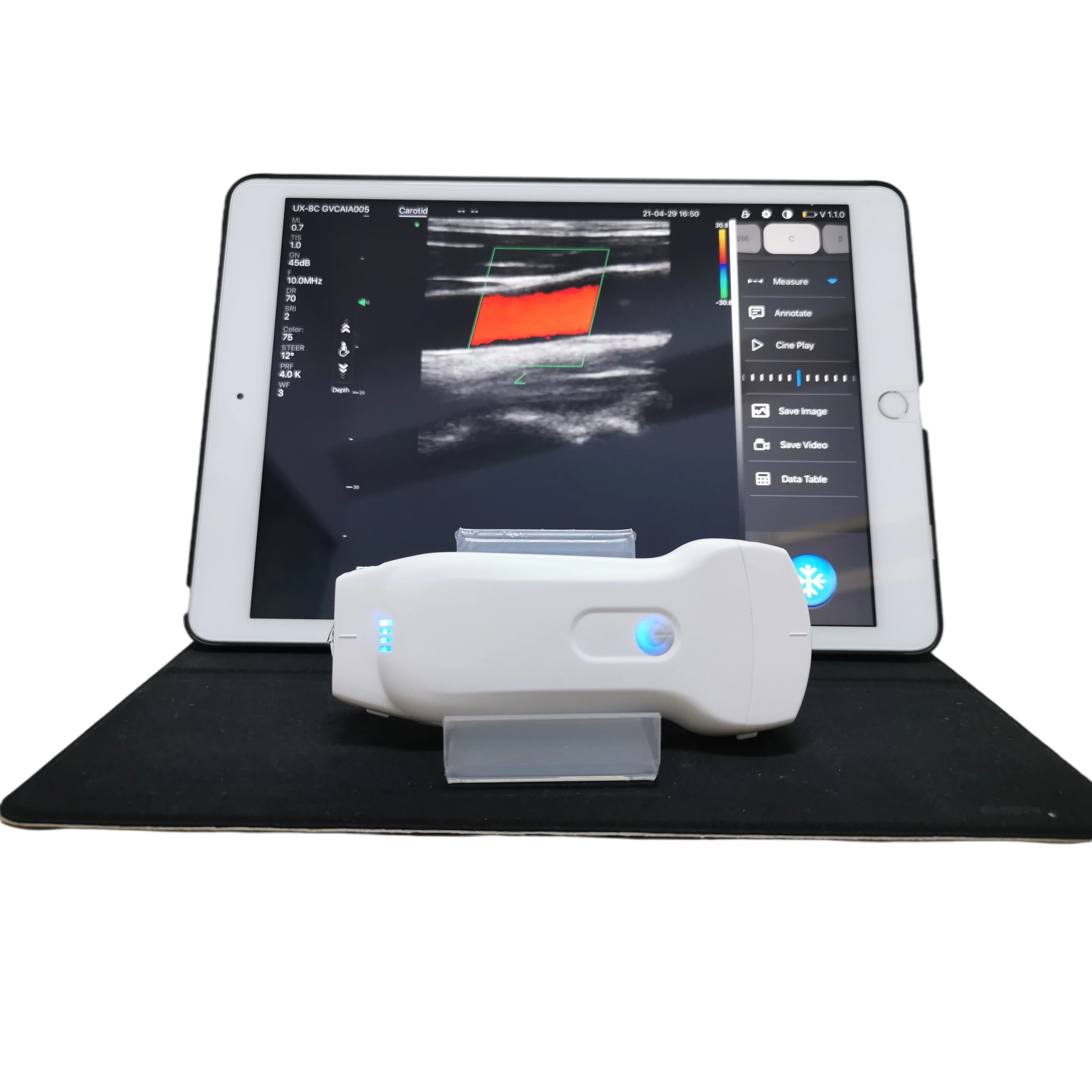 Highest Cost-effective Double Probes Wireless Color Doppler Ultrasound Scanner ultrasound probe wireless linear