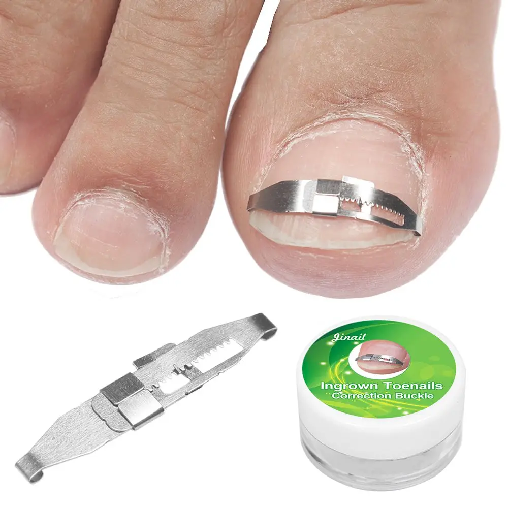

Effective Professional Health Care Nail Recover Correction Pedicure Tools Ingrown Toenail Straightener Paronychia