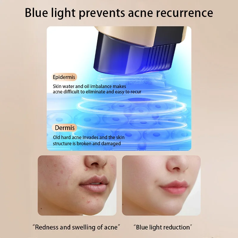 RF Thermage Домашнее косметическое устройство Омоложение красного света для лица EMS