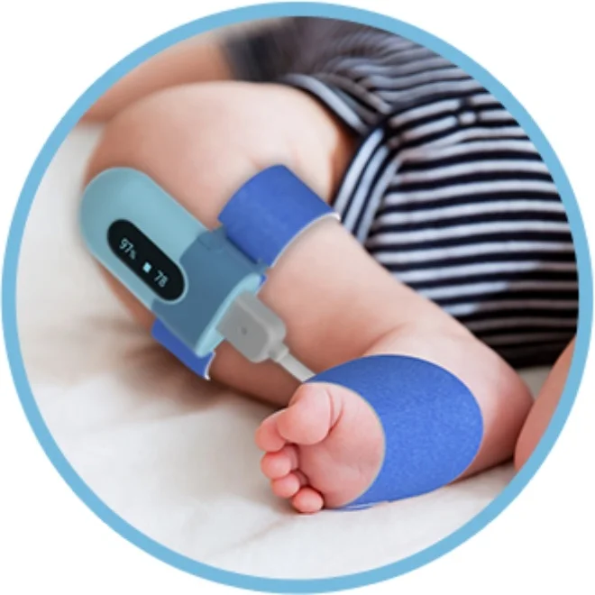 

Wellue BabyO2 Smart Sock Infant Pulse Oximeter Baby Pulse Oximeter wireless