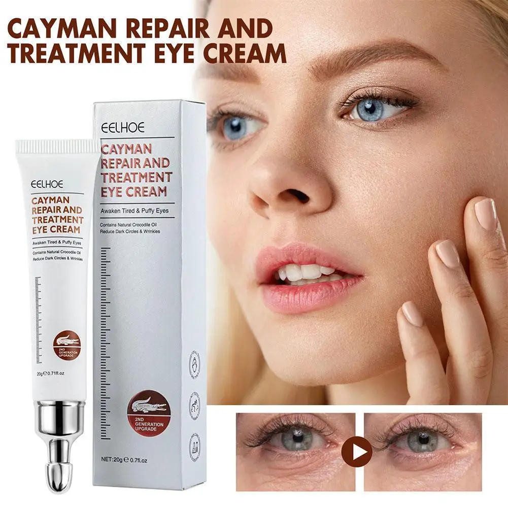 

Magic Anti-Aging Eye Cream Eye Cream Reduces Dark Circles Puffy And Cream Repair Under Eyes Crocodile Puffy Eye B7P7