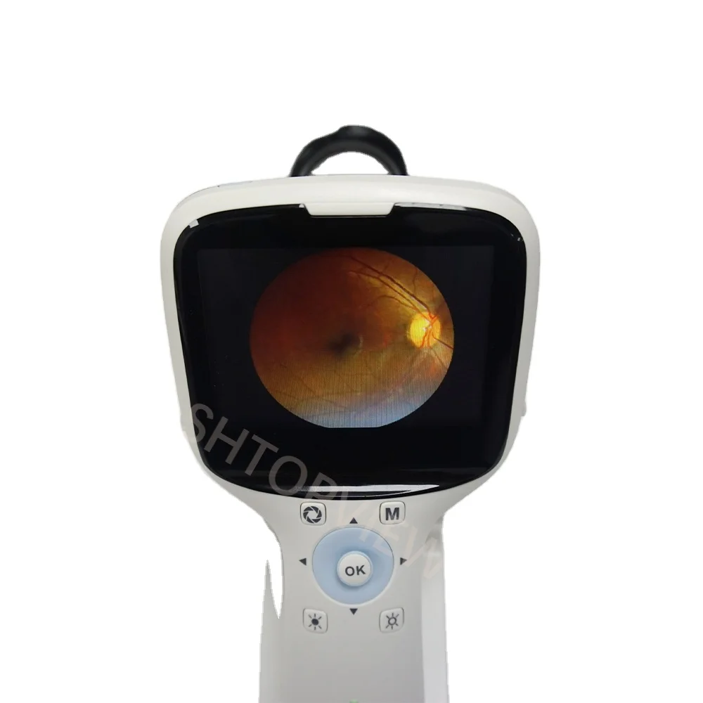 

China Newest Digital Auto Portable fundus camera Eye Test Ophtical Instrument PFC