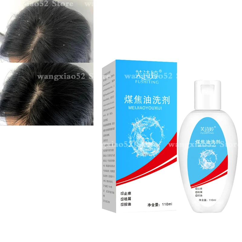 

Genuine coal tar lotion shampoo wash antibacterial liquid anti-dandruff itching oil control refreshing suitable for oily hair