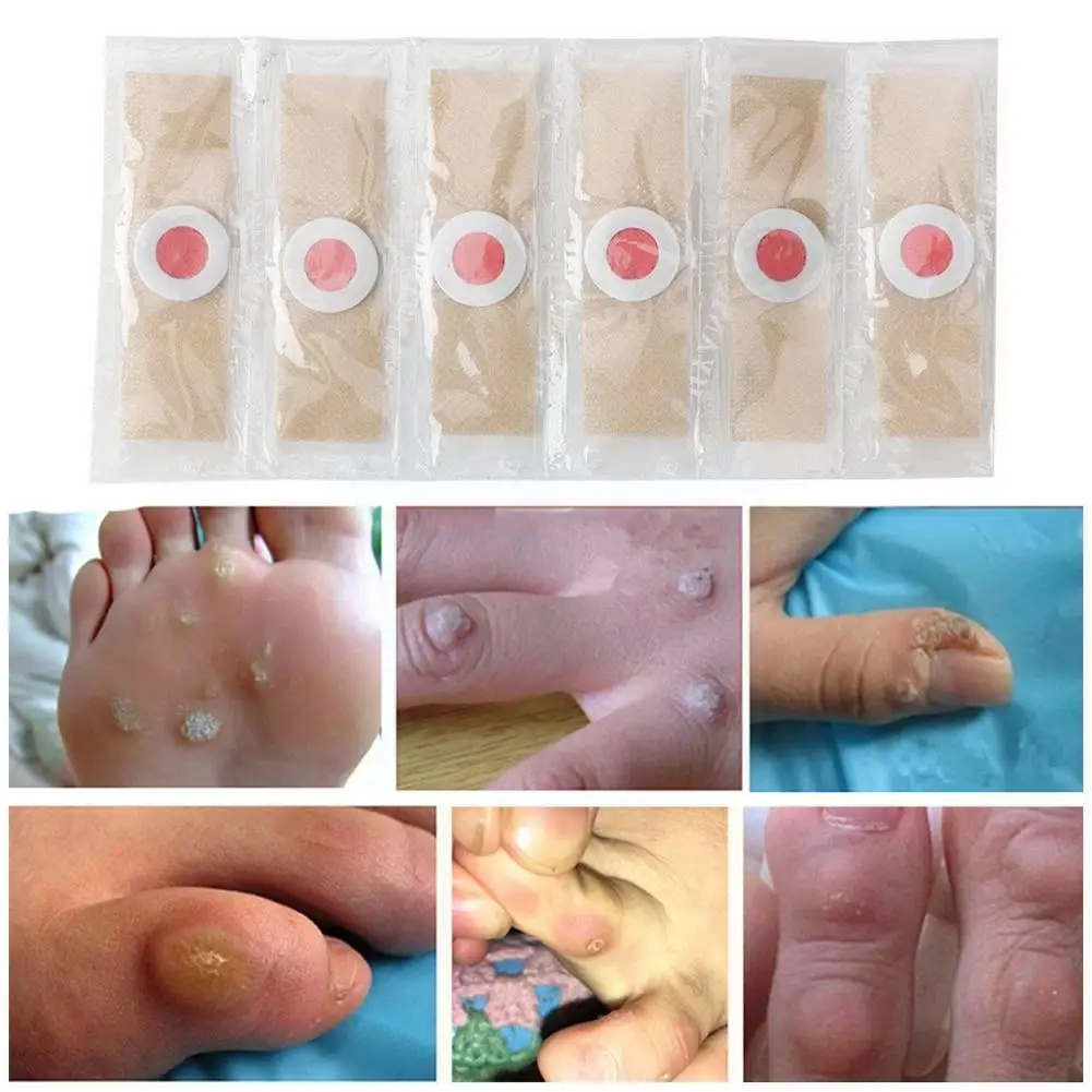 

5pc Foot Corn Removal Patch Old Calluses Plantar Warts Pads Corn Feet Detox Sticker Thorn Foot Foot Care Curative Plaster A8p8