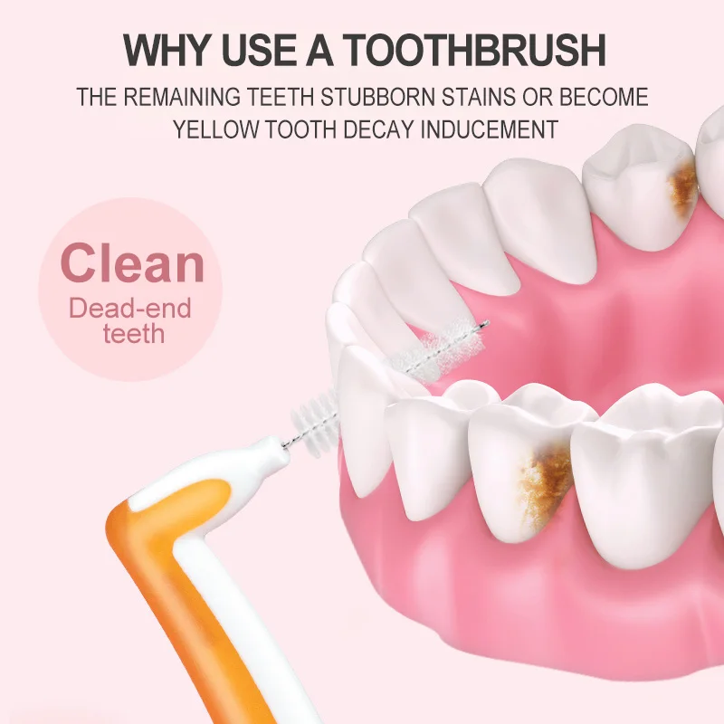 Fawnmum межзубная щетка L-типа для стоматологической ортодонтики очистка в