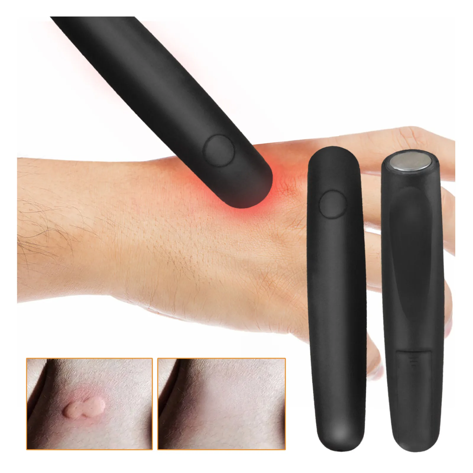 

For Itching Bite Insect Mosquito Portable Pen Black Relieve Adult Children Anti-itch Physical Itch Stick Stop Antipruritic