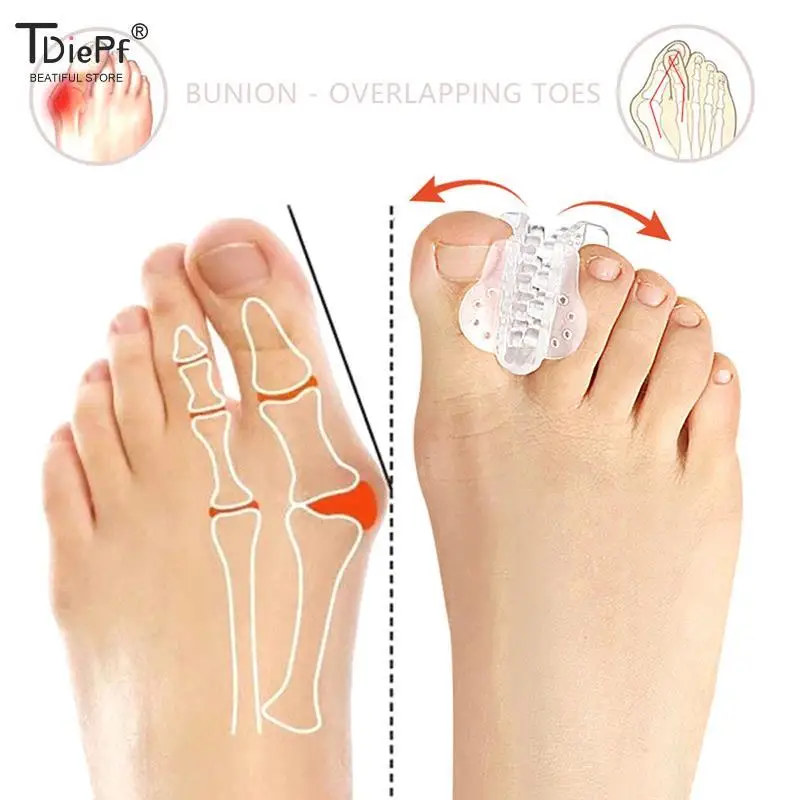 

1Pair New Bunion Device Hallux Valgus Orthopedic Braces Toe Correction Foot Care Corrector Thumb Goodnight Daily Big Bone Tools
