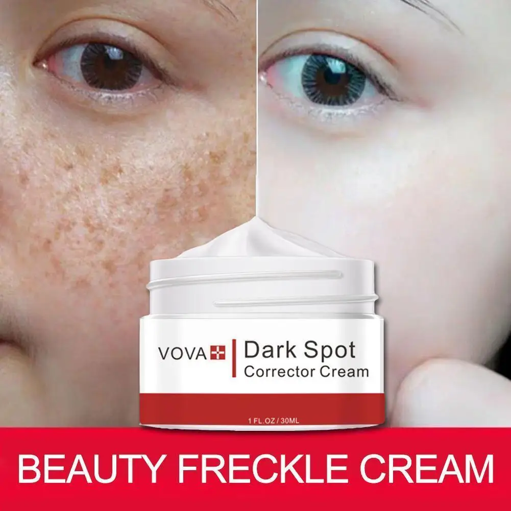 

30g Beauty Freckle Cream Fading Melanin Freckle Cream Spot Face Care Care Products Skin Removal Chloasma Whitening S5r9