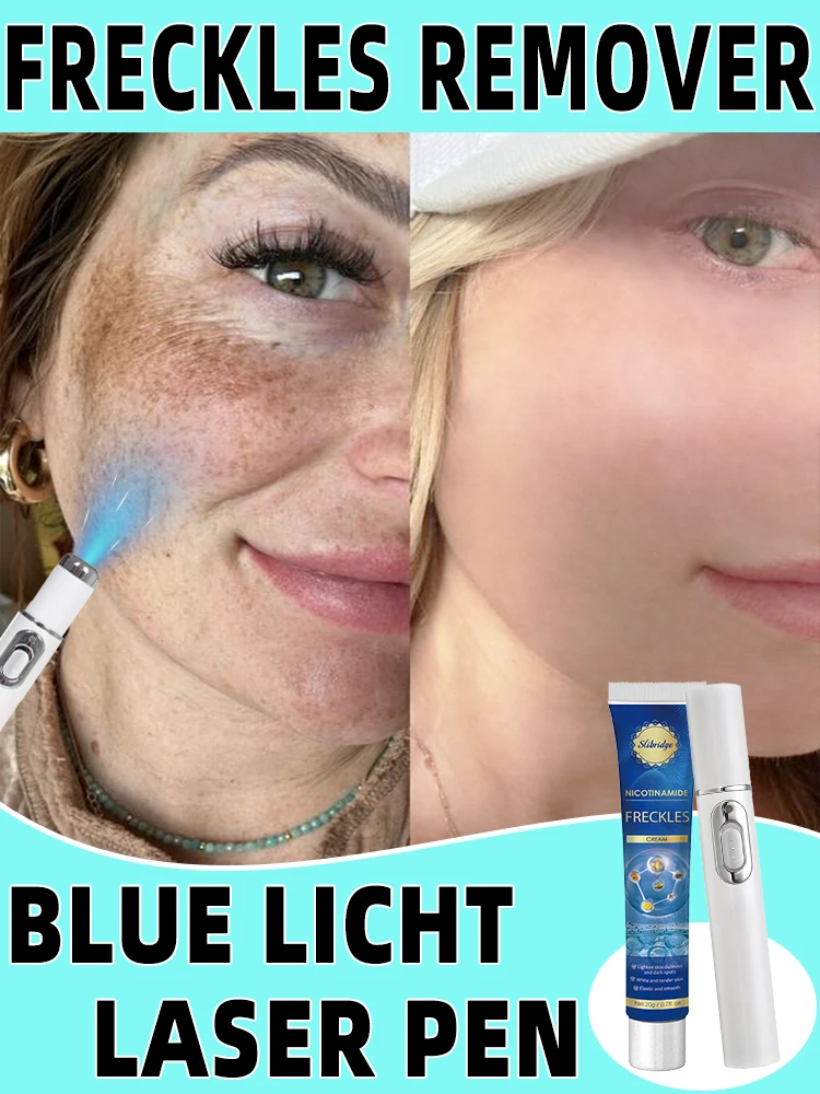 Справитесь с проблемой Frec-kles