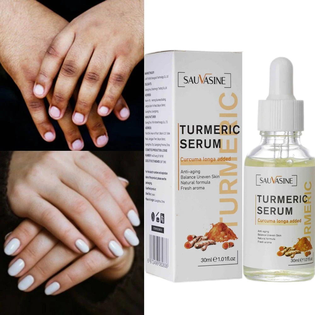 

Body Turmeric Lemon Oil Skin Glow To Lightening Acne Dark Patches Acne Bright Skin Dark Spot Corrector Face Whitening Serum