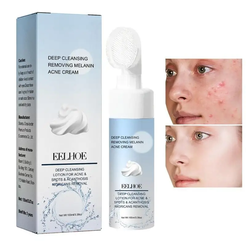 

Tea Tree Cleanser Gentle Face Cleanser For Sensitive Skin Oily Skin Facial Cleansing Pore Cleaner Natural Hydrating Face Wash