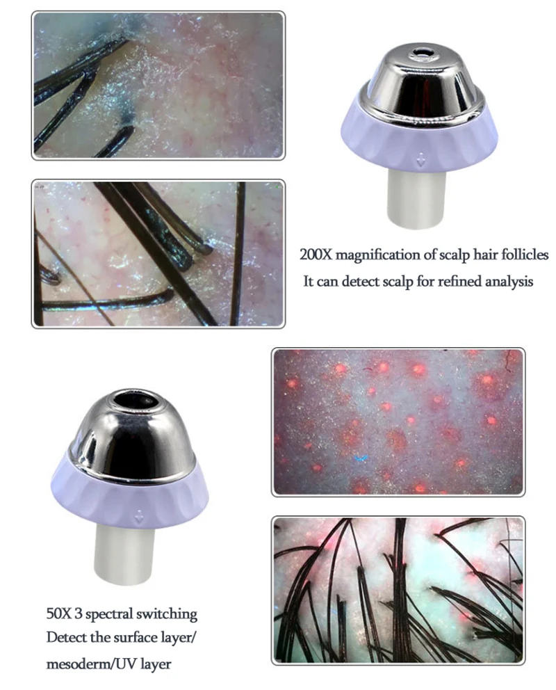 11-дюймовый фотоаппарат профессиональный детектор кожи головы тестер влажности