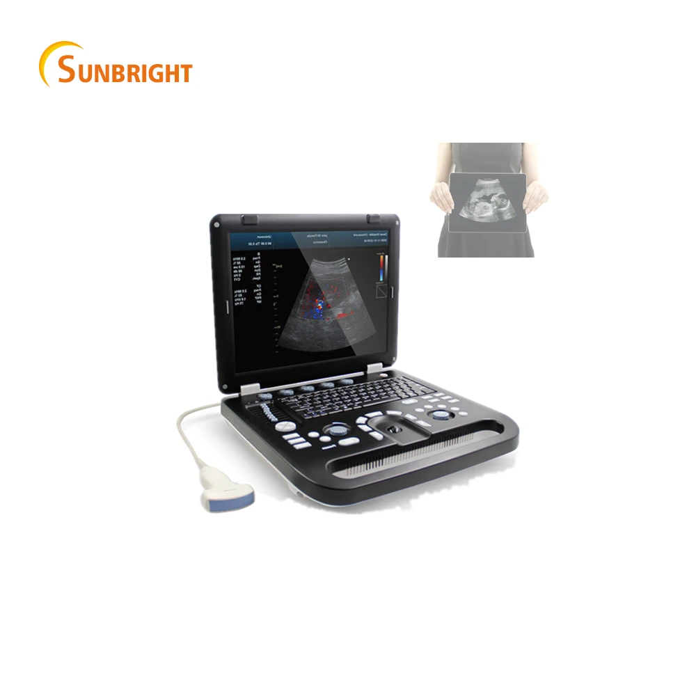 

Medical scan 3D ultrasound portable color doppler for fetal image