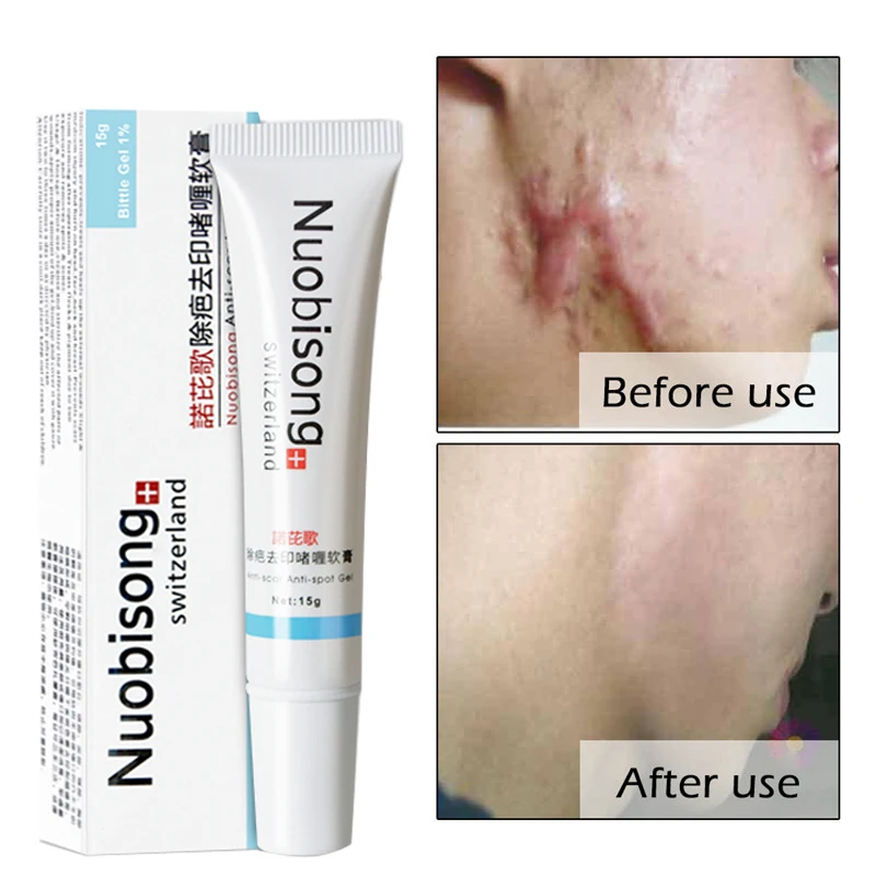 

Drop Shipping Nuobisong Facial Scar Removal Cremas Facial Spots Treatment Whitening Face Cream Stretch Marks Moisturizing