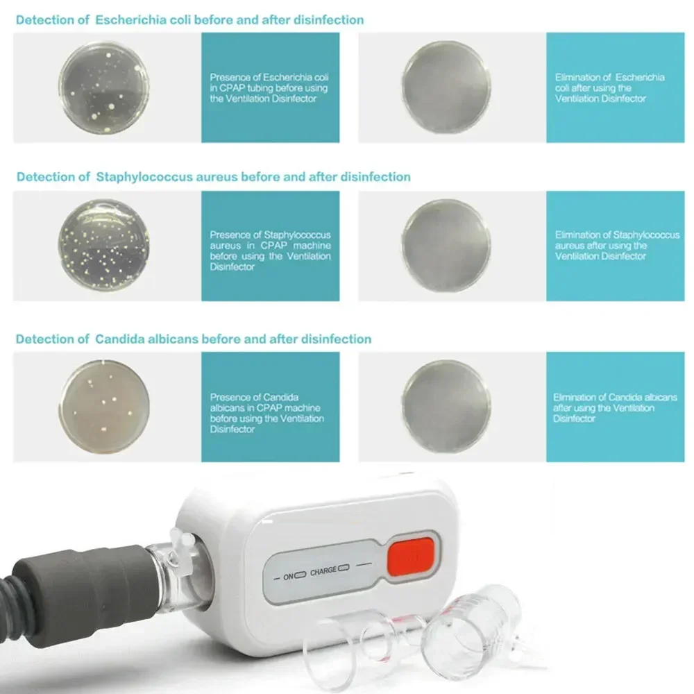 XD100 портативный CPAP очиститель озоновый вентилятор для сна воздуха дезинфекция