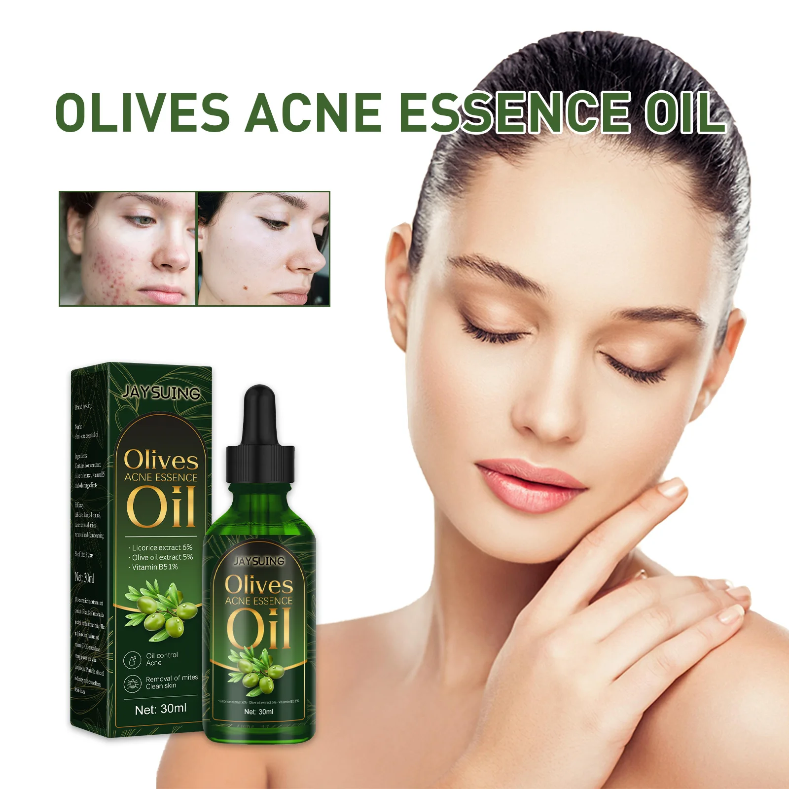 

Olive Pure Acne Essential Oil Removes Facial Oil Acne Mild Moisturizing Acne Liquid Fades Facial Acne Essential Oil 30ml