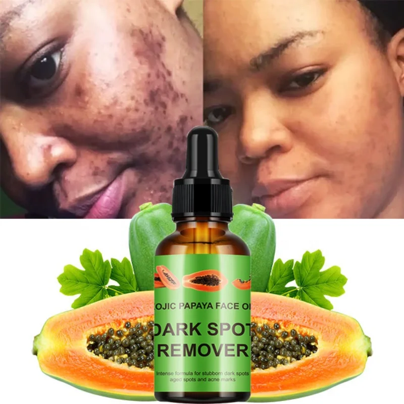 Kojic Acid Anti Wrinkle Serum,Dark Spots Acne Removal,Melasma Anti Aging Kojic Acid Papaya Face Serum