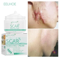 scar removal cream pimples stretch marks remove acne spots burn surgical scars treatment smoothing whitening cosmetics skin care