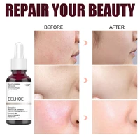 salicylic acid shrink pores serum fruit acid exfoliating moisturizing nourish smooth pores repair essence products skin care