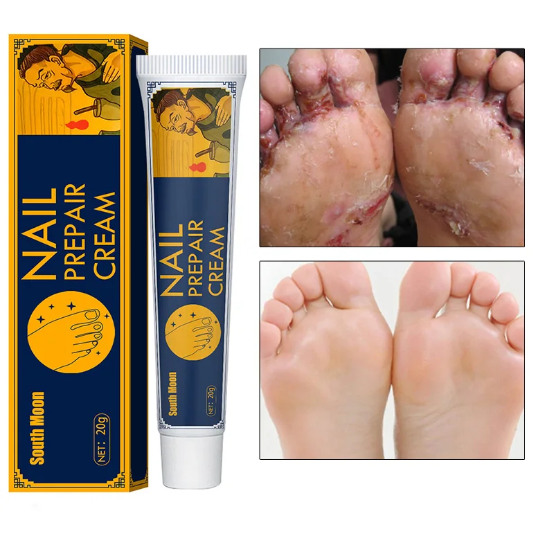 

Эффективный антигрибковый крем для ног, удаление грибка, снятие зуда, увлажнение, бритья, Лечебный крем