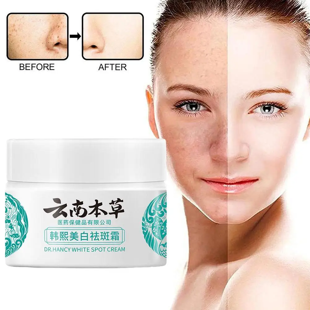 

20g Yunnan Herb Powerful Whitening Freckle Cream Remove Acne Spots Dark Spots Face Moisturizing Face Skin Care Beauty