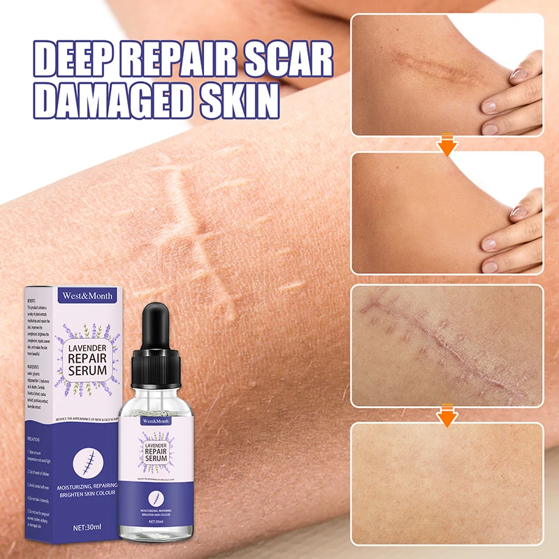 

Lavender Scar Fade Repair Essence Fade Acne Marks Surgery Scar Smoothing Skin Repair Acne Scar Removal Serum Whitening Skin Care