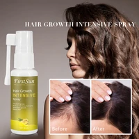 30ml ginger hair growth essence spray hair loss treatment preventing hair loss spray hair growth essence hair care