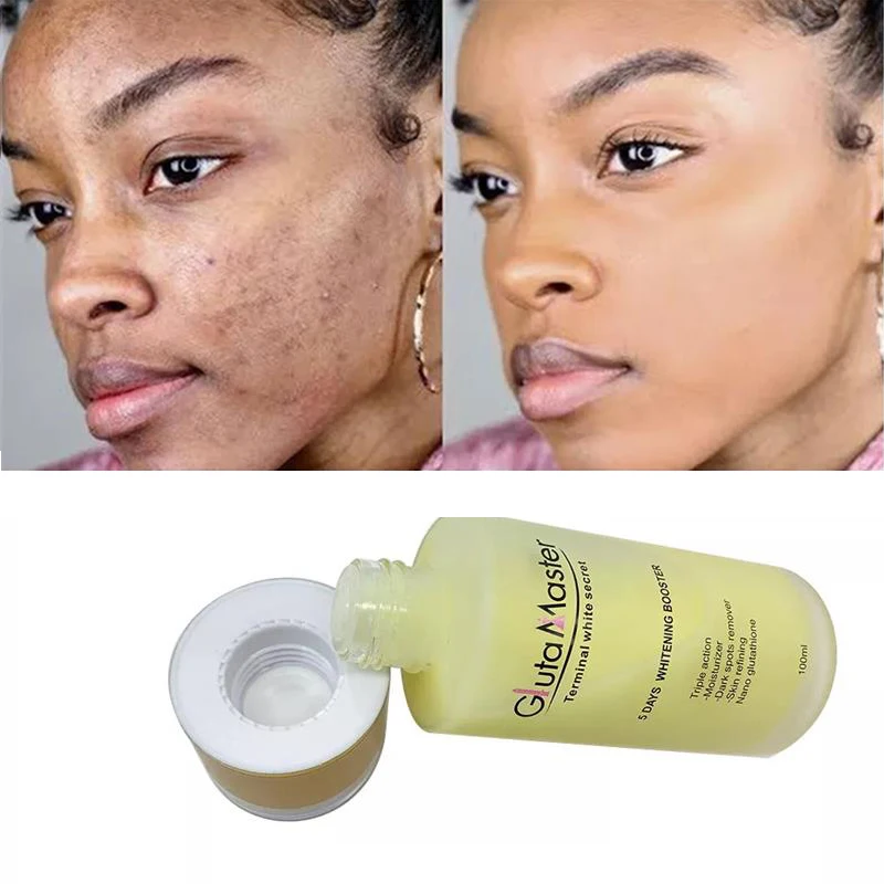 Сыворотка Gluta Master Glutathione отбеливающая фотоэссенция для удаления пятен и кожи лица