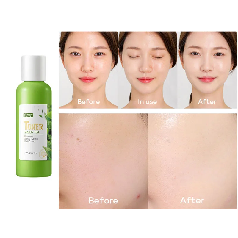 

FENYI Green Tea Face Tonic Hydration Smooth Facial Toner Skin Care Anti-Acne Oil Control Moisturizing Whitening Soften Skin