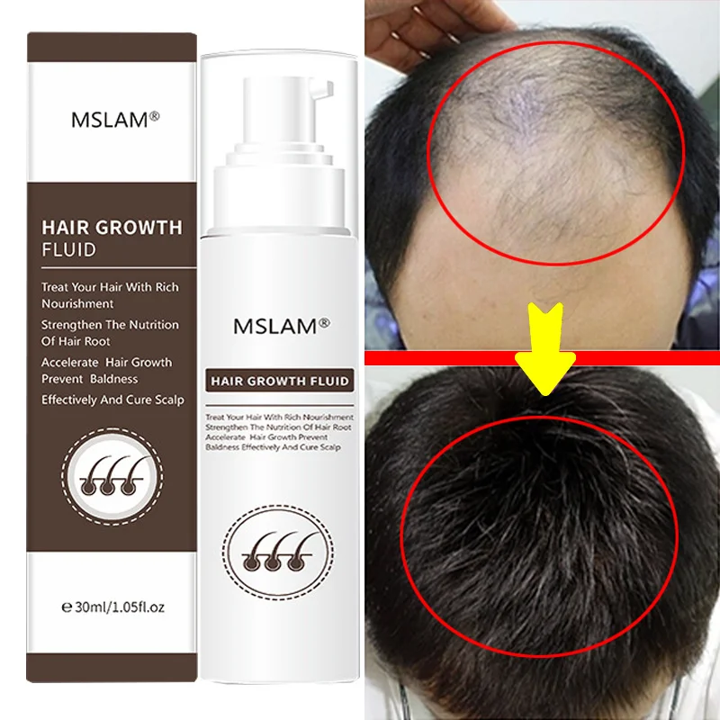 

Fast Hair Growth Spray Anti Hair Loss Scalp Treatment Oil Prevent Baldness Repair Thinning Dry Damaged Beauty Hair Care Products