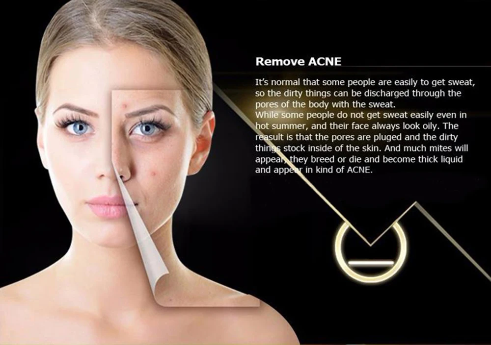 10 шт./лот косметический уход за лицом травяное средство для удаления душек в носу