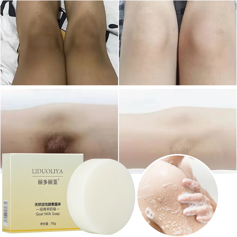 

Body Whitening Soap Chicken Skin Removal Underarm Knees Bleaching Soap Dark Spot Removal Dead Skin Moisturizing Body Treatment