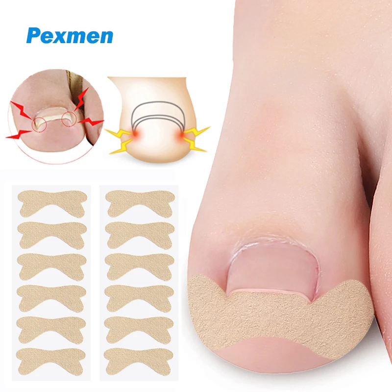 

Pexmen 6/12/30Pcs Ingrown Toenail Correction Sticker Adhesive Toenail Patch Elastic Nail Treatment Corrector for Men and Women