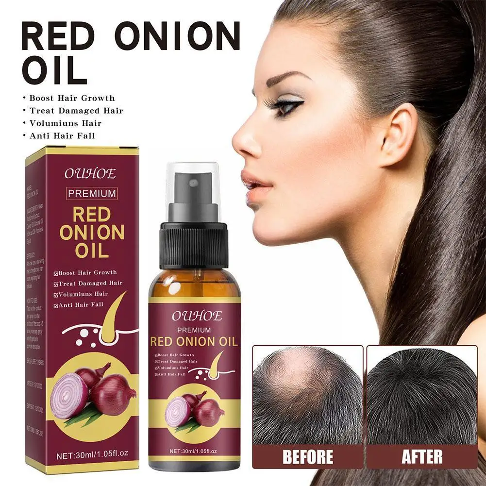 

30ml Essential Oils Essence Spray Anti Alopecia Treatment Growth Nourish Oil Hair Care Fast Essential Injury Dry Y3S8
