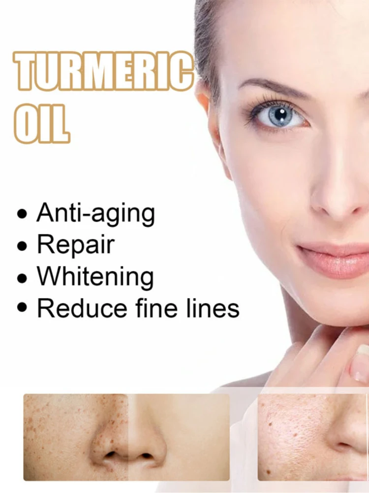 

Сыворотка куркума, куркумное масло, оригинальные осветляющие эфирные масла для омоложения кожи, корректор пигмента, отбеливание кожи