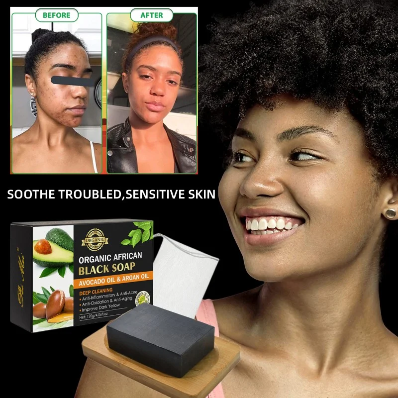 Argan Oil African Black Soap Moisturizing Acne Cleanser For Clear Skin Care Handmade Soap Bar For Face Body