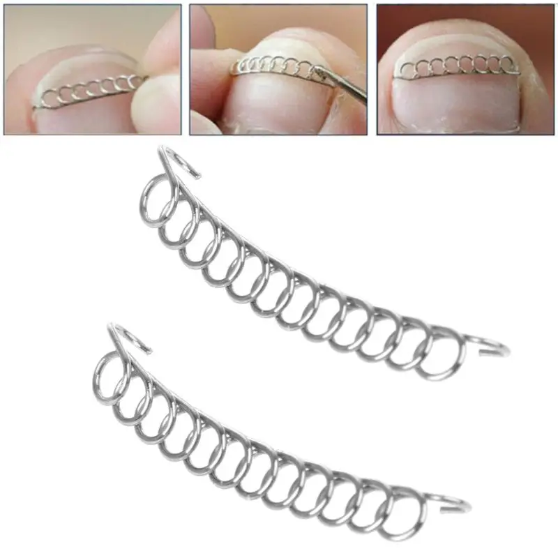

Ingrown Toe Nail Correction Pedicure Wire Fixer Paronychia Recover Tool Home