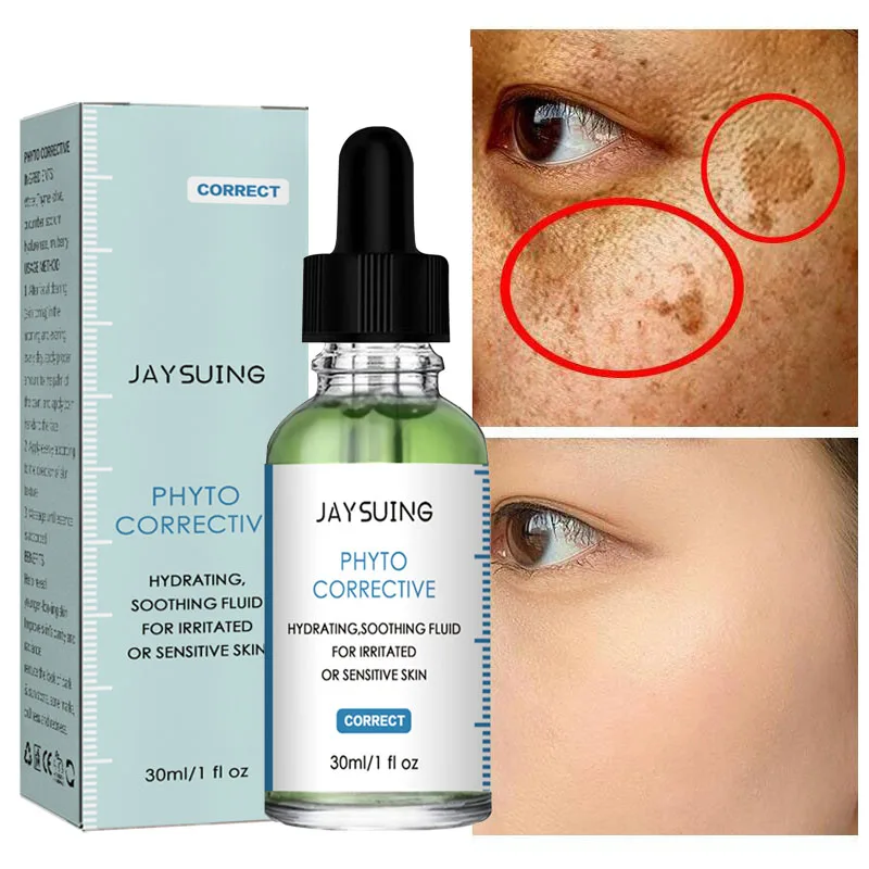 

Whitening Freckle Face Serum Dark Spots Remover Fade Melanin Melasma Essence Anti Aging Brighten Moisturizing Korean Skin Care