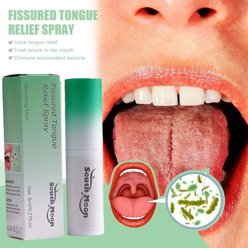 

8ml Fissured Tongue Relief Spray Breath Freshener Spray Health Mouth Oral Natural Health Regulates Flavor Care Mint Essence E2D0