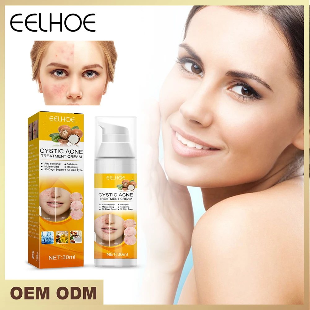 

Крем для удаления акне, 30 мл