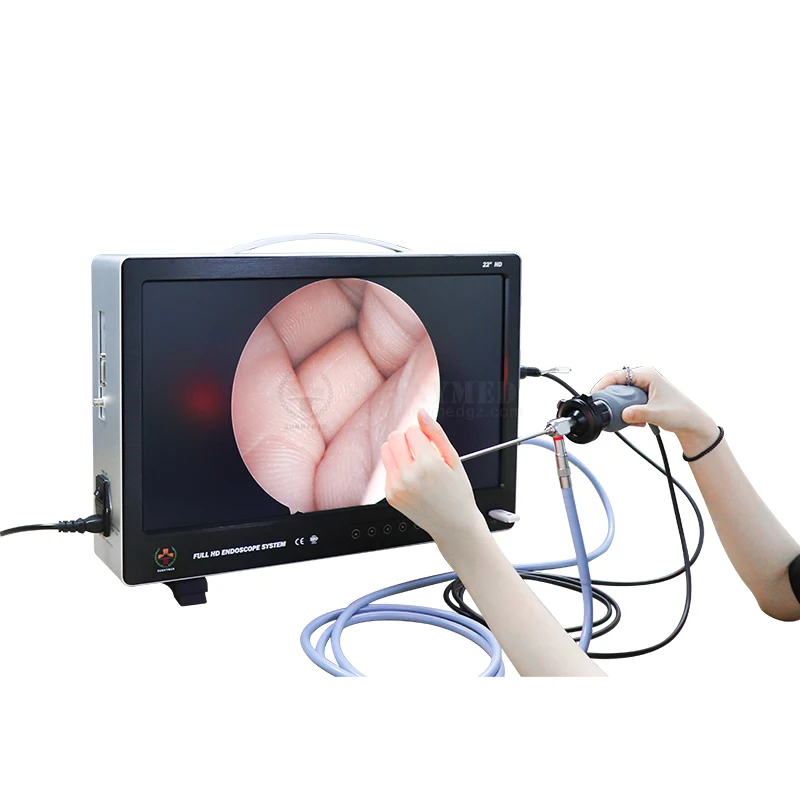 

SUNNYMED SY-PS050 New Arrival HD Camera Rigid Endoscope Integrated ENT Endoscope System