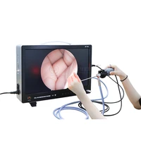 sunnymed sy ps050 new arrival hd camera rigid endoscope integrated ent endoscope system