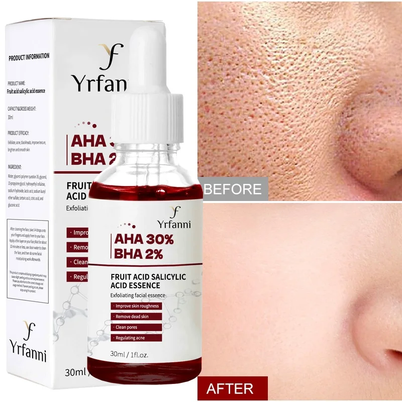 

Pore Shrinking Serum Salicylic Fruit Acid Essence Anti Aging Acne Remove Oil Control Whitening Moisturizing Beauty Skin Care