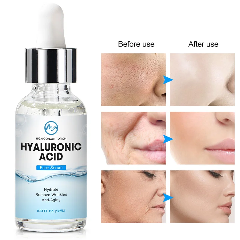 

Minch Hyaluronic Acid Serum Face Care Moisturizing Anti-Aging Whitening Facial Essence Anti-Oxidation Face Serum Skin Care