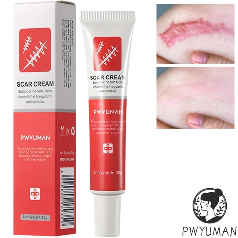 

Fast Scar Removal Cream Stretch Marks Burn Treatment Fade Acne Spots Surgical Scar Repair Gel Firming Smoothing Body Skin Care