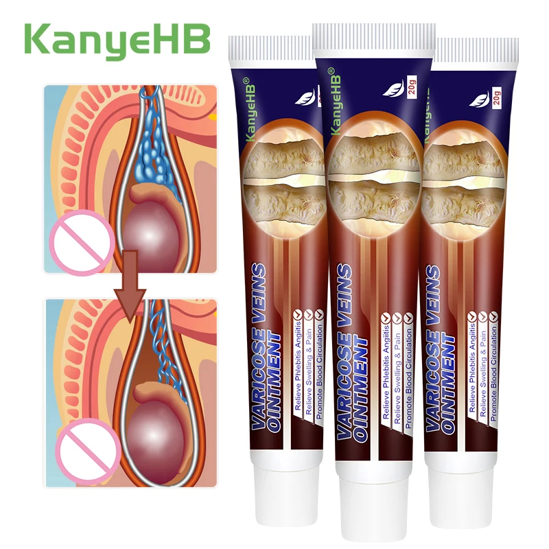 

1/3/5/7Pcs Varicose Vein Treatment Ointment Genitals Varicocele Herbal Cream Relief Blood Vessel Swelling Pain Phlebitis Cream