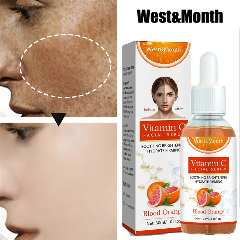 

Vitamin C Whitening Freckle Serum Remove Dark Spot Pigmentation Melasma Anti-Aging Hyaluronic Acid Moisturizing Brighten Essence