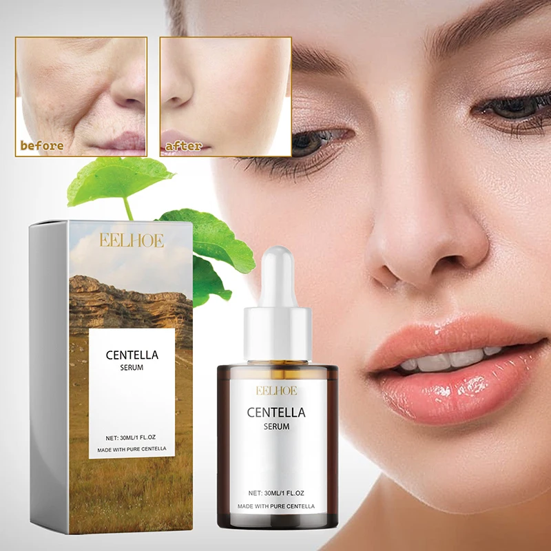 100/30 мл эссенция Centella увлажняющая и улучшающая сухую кожу мягкая осветляющая