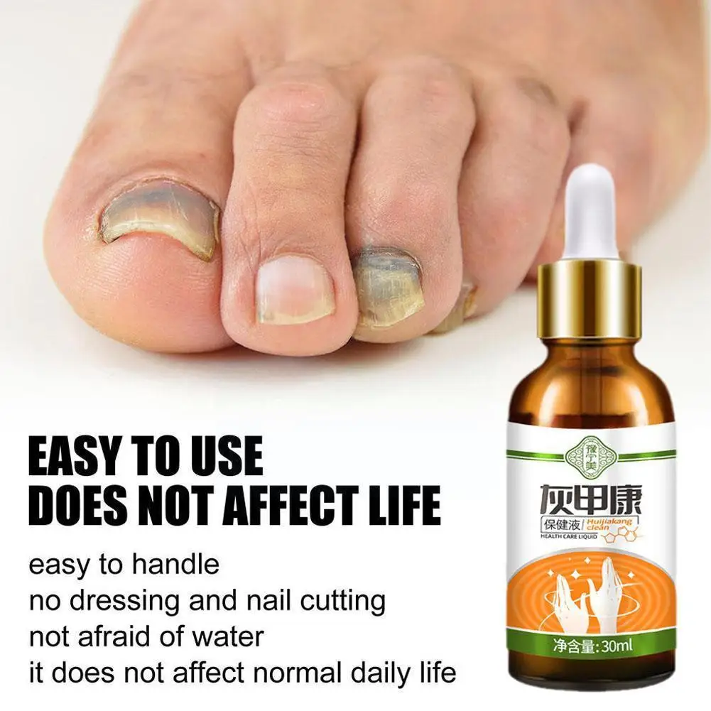 

2023 восстанавливающая сыворотка для ногтей эссенция для удаления грибка ногтей инфетрирующие ногти Сияющий гель ремонт ногтей анти маслом для ногтей 30 мл уход отдых K8s1